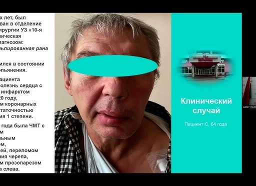 Гипонатриемия