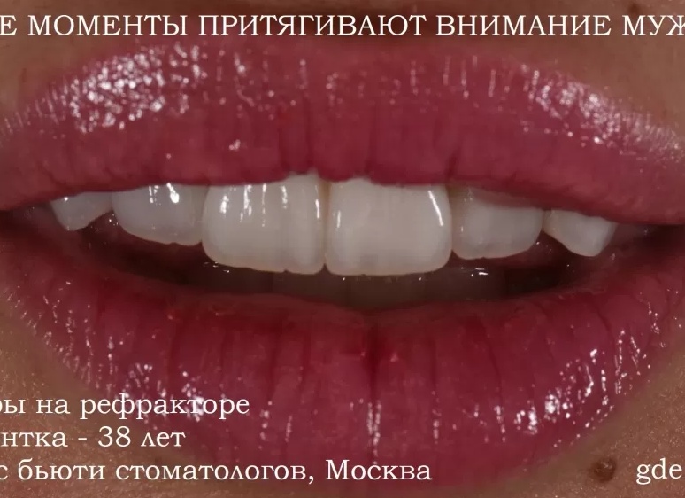 🔥Какую медицину выбирает Московская молодежь
