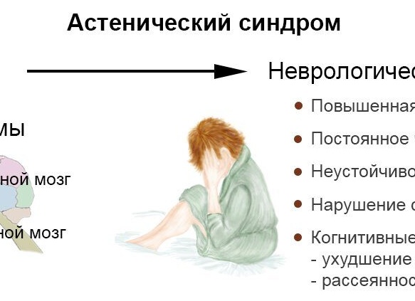 Астенический синдром