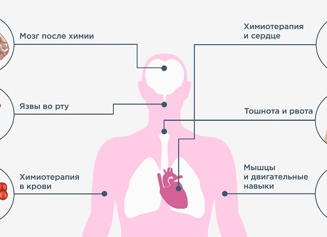 Поддержка организма ПОСЛЕ химиотерапии
